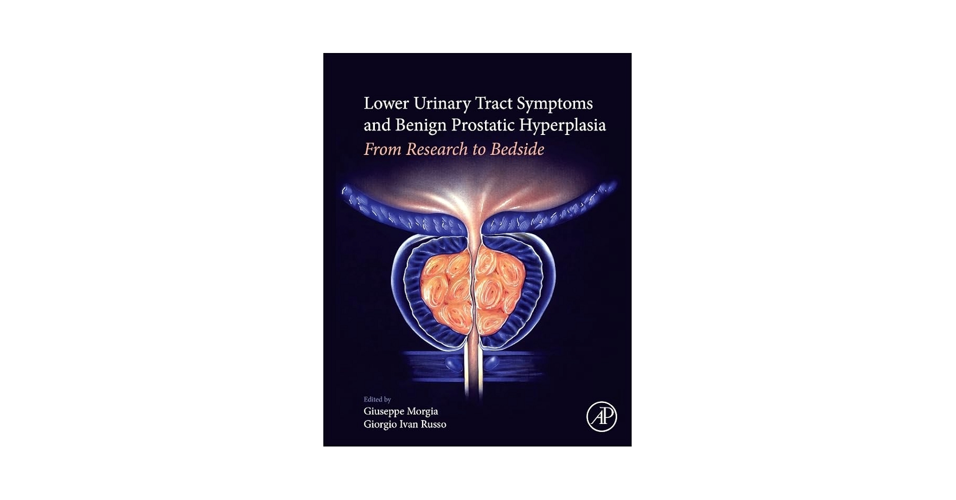 AFIP4th #14 Tumors of the Prostate(新本) AFIP4th #14 Tumors of the Prostate(新本)